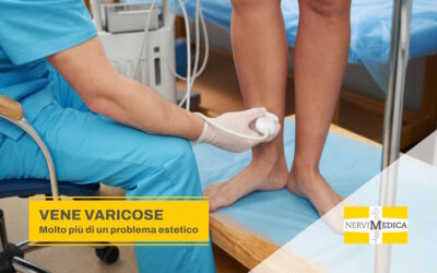 Vene varicose, a chi rivolgersi?