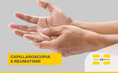 Reumatologia: cos’è la capillaroscopia?